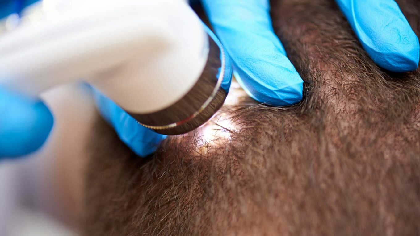 Medical examination of the hair and scalp